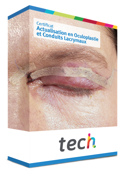 Certificat En Actualisation En Oculoplastie Et Conduits Lacrymaux