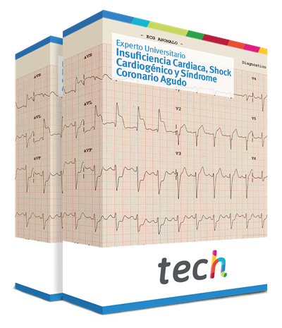 Experto Universitario En Insuficiencia Cardiaca Shock Cardiog Nico Y