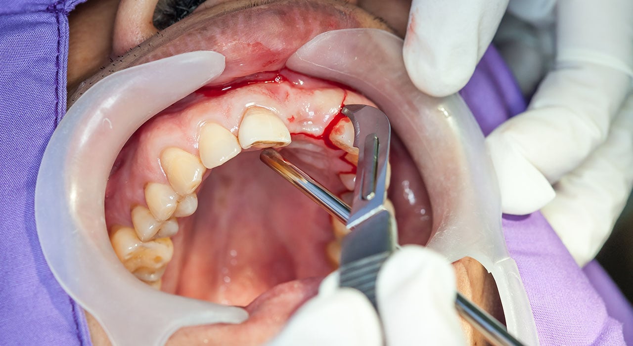 Grand Master en Periodoncia Implantología y Cirugía Bucal TECH México