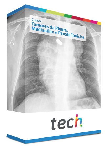 Curso de Tumores da Pleura, Mediastino e Parede Torácica - TECH Brasil