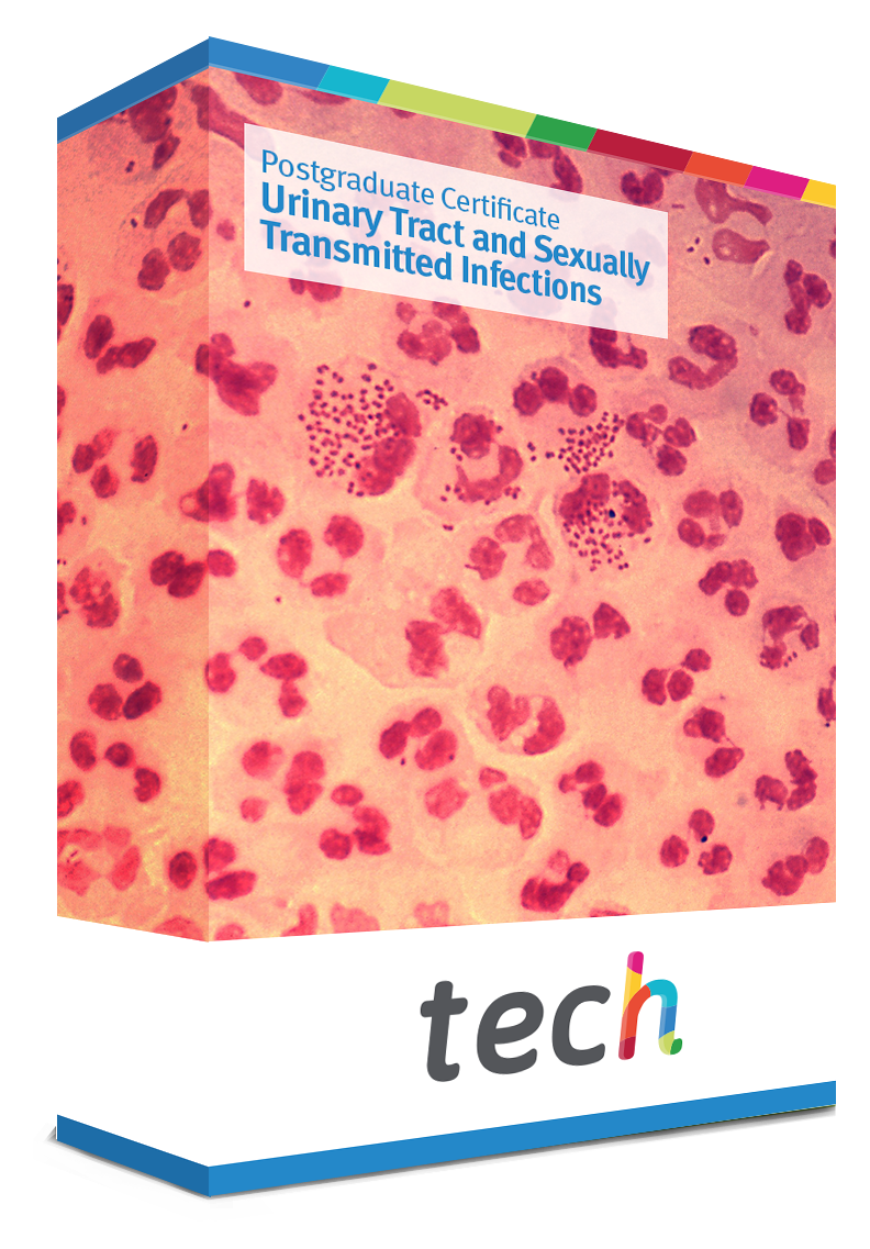 Postgraduate Certificate In Urinary Tract And Sexually Transmitted Infections Tech Malaysia 4654