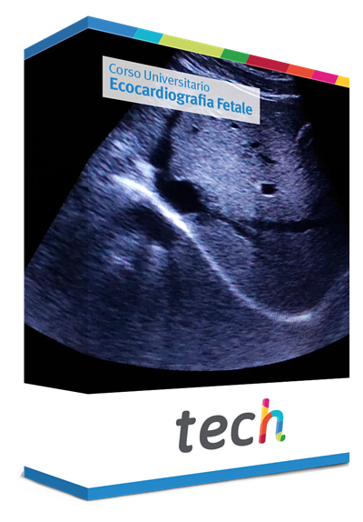 Ecocardiografia Fetale