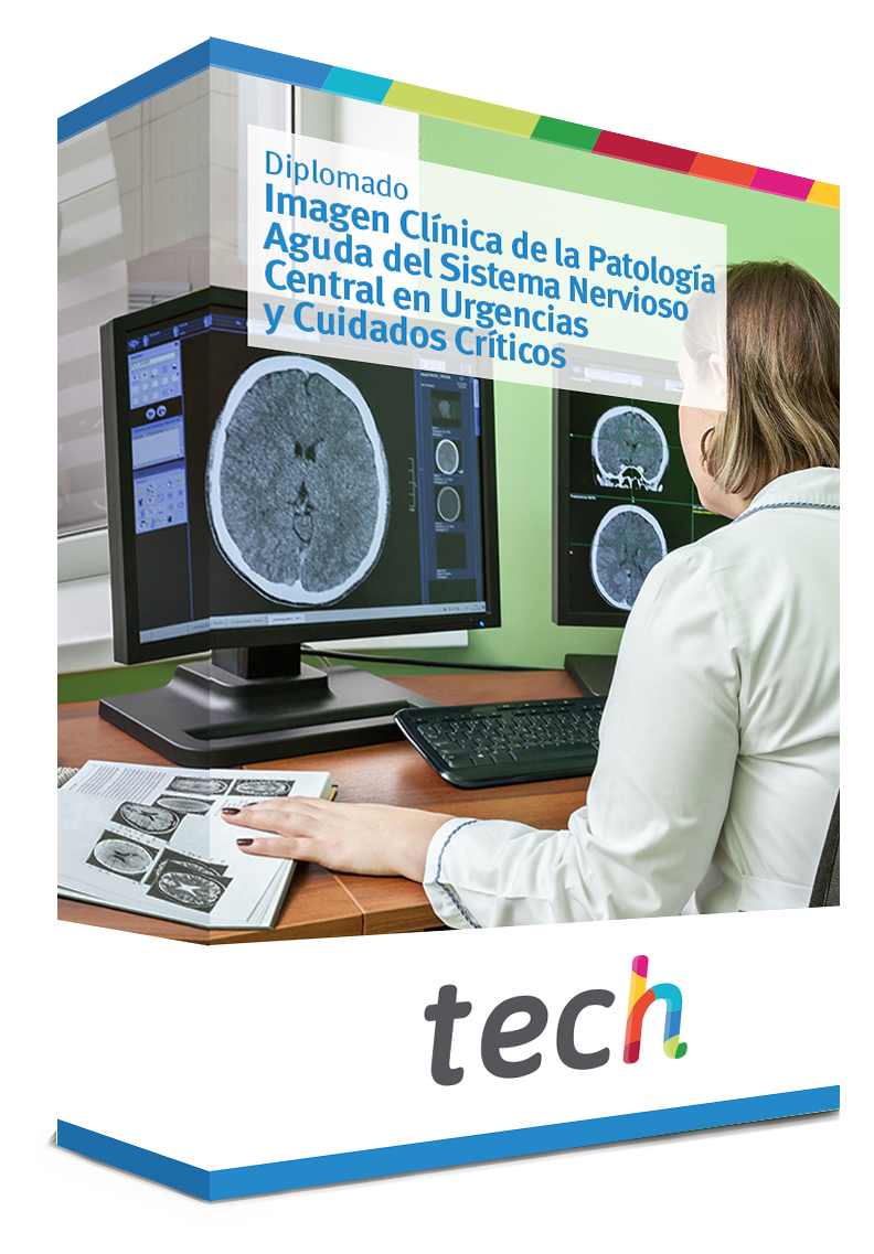 Diplomado En Imagen Clínica De La Patología Aguda Del Sistema Nervioso
