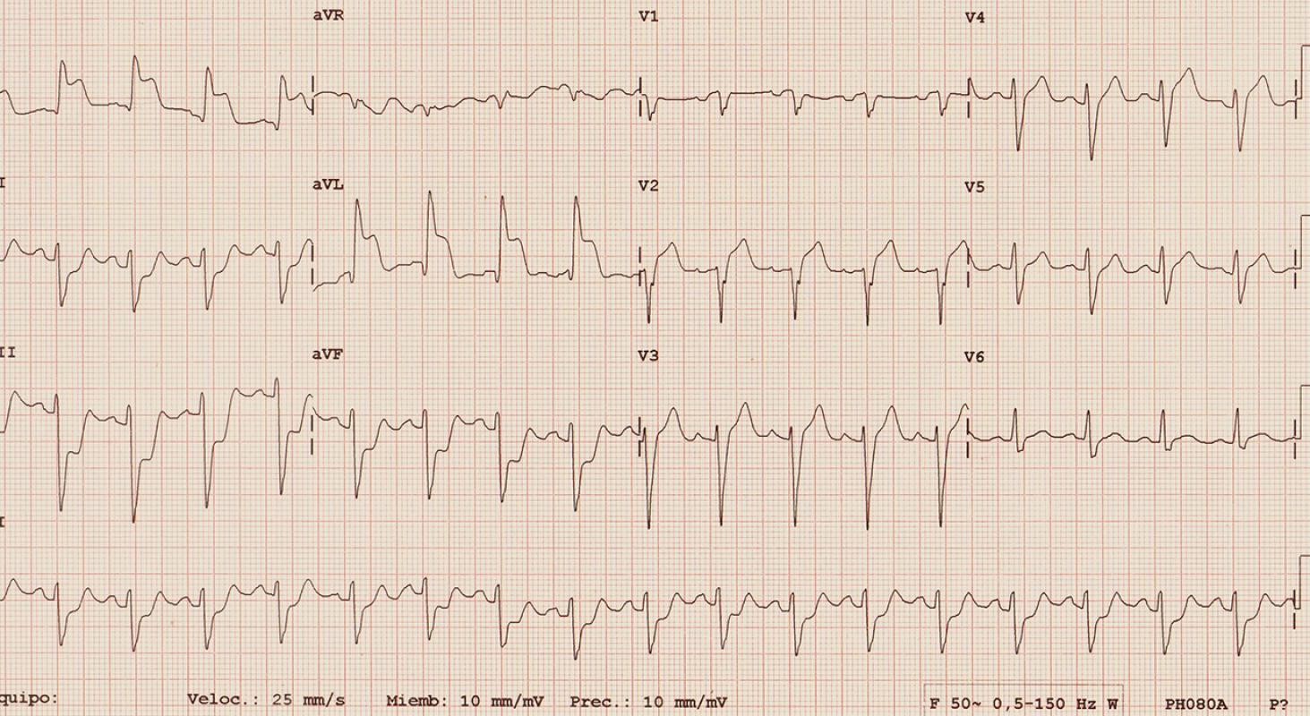 Especialización En Insuficiencia Cardiaca, Shock Cardiogénico Y ...