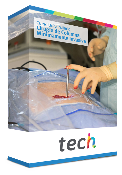 Curso Universitario en Cirugía de Columna Mínimamente Invasiva - TECH España